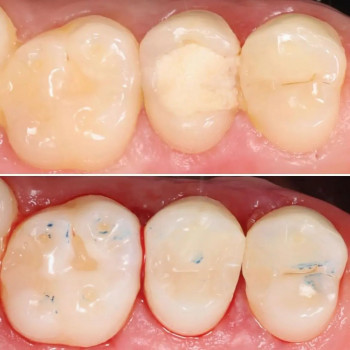 Володимир Вечірко, Винница Фото - 7