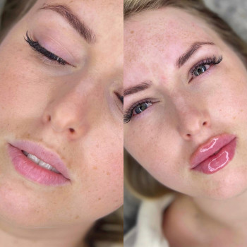 Тетяна Асколіна, Вінниця Фото - 5