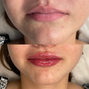 Ірина Шкаранда, Винница Фото - 5