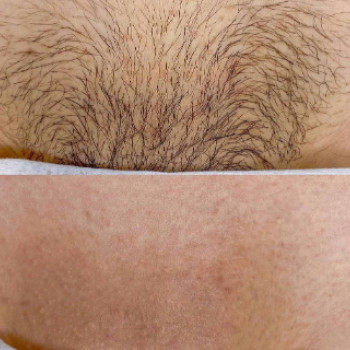 Людмила Коломацкая, Днепр Фото - 5