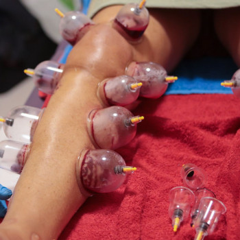 Аль-Хіджама!