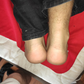 Корекція довжини ніг!