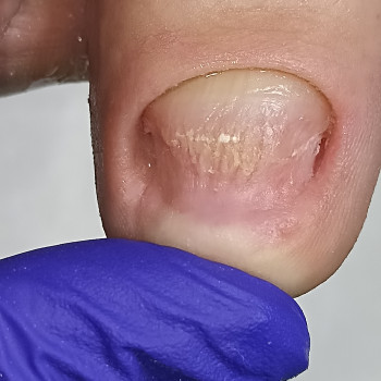 Здорові ніжки, Запоріжжя Фото - 7