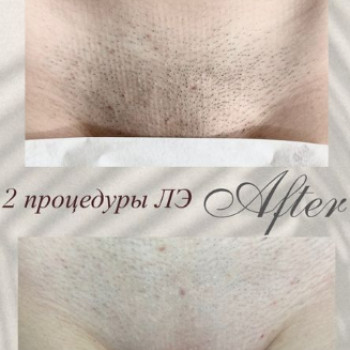 Елена Кушнир, Одесса Фото - 5