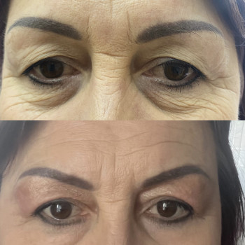 Наталія Довгополова, Одеса Фото - 2