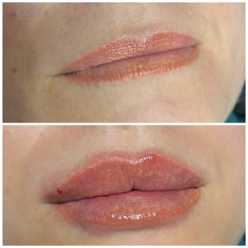 Наталія Довгополова, Одеса Фото - 5