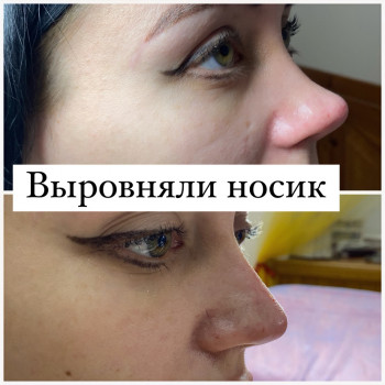 Наталія Довгополова, Одеса Фото - 11