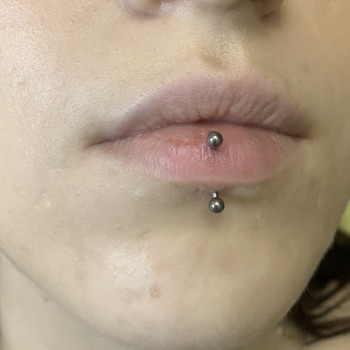 Вертикальный лабрет