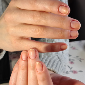 Любов Серман, Ивано-Франковск Фото - 20