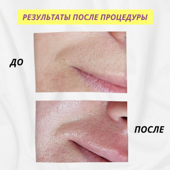 ElectroEpil, Одесса Фото - 5