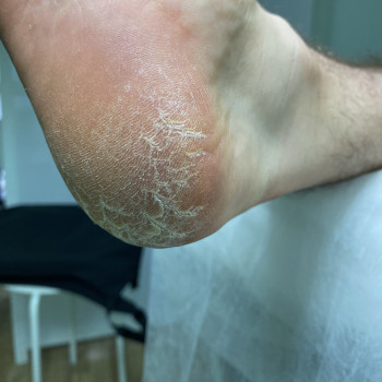 Євгенія Токмакова, Київ Фото - 30