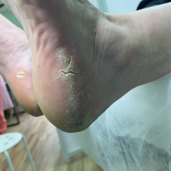 Євгенія Токмакова, Київ Фото - 35