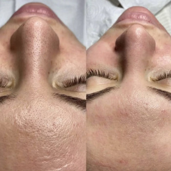 Лилия Бугаленко, Черноморск Фото - 8