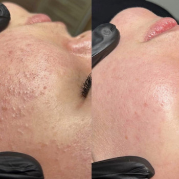 Лилия Бугаленко, Черноморск Фото - 9