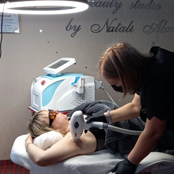 Лазерна епіляція діодним лазером
