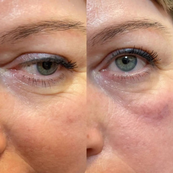 косметологічні процедури