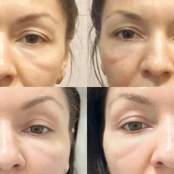 косметологічні процедури