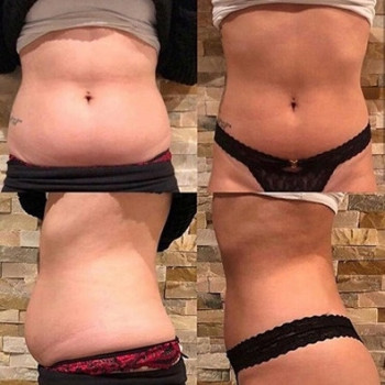 Тут пропрацьовували зону животика
Результат вау