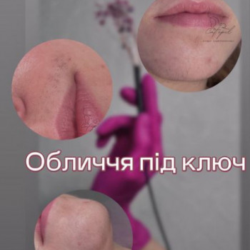 Cat Epil, Одесса Фото - 5