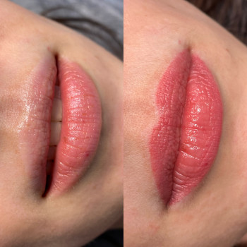 До і заживші