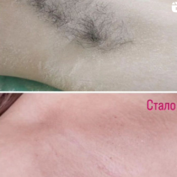 Наталья , Одесса Фото - 5