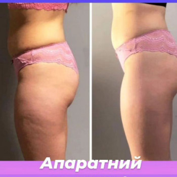 Міла Гудіс, Одеса Фото - 5