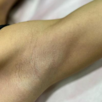 Элла Степанова, Одесса Фото - 5