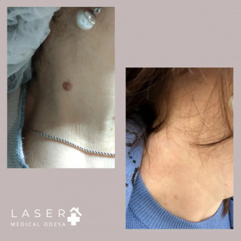 Laser Medical, Одеса Фото - 5