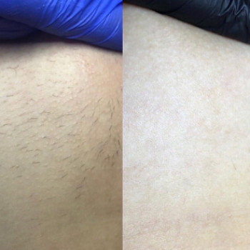 Інна , Одеса Фото - 6