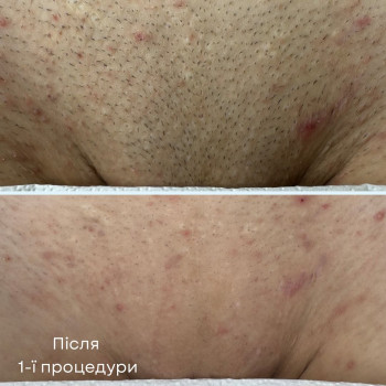 Savchuk Laser, Одеса Фото - 5