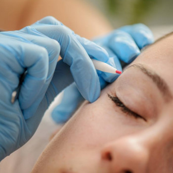 Baeva Epil, Одесса Фото - 5