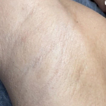 Epil Estetic, Одеса Фото - 5