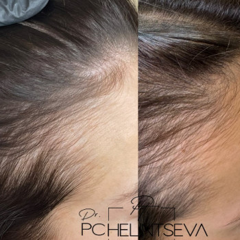 Татьяна Пчелинцева, Одесса Фото - 5