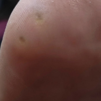 Дарʼя Гладишевська, Одесса Фото - 7