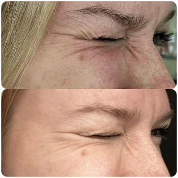 Наталья Девятова , Київ Фото - 16