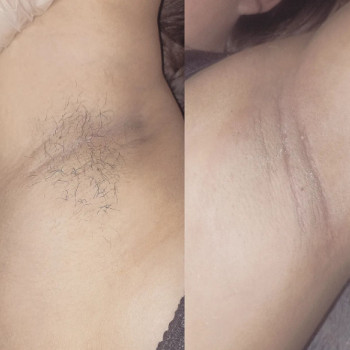 Ірина Купча, Одеса Фото - 5