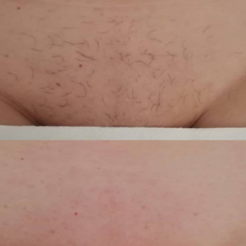 Оксана Полищук, Одесса Фото - 5