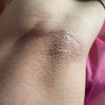 Анастасия , Харьков Фото - 5