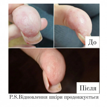 Ганна Філоненко, Кременчук Фото - 1