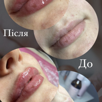 Марина Погорілко, Киев Фото - 4