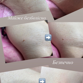 Марина Погорілко, Киев Фото - 5