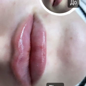 Марина Погорілко, Киев Фото - 11