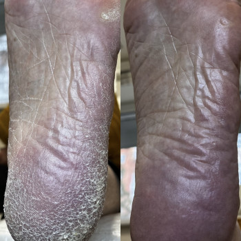 Анна Ращупкіна, Полтава Фото - 7