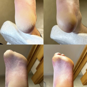 Анна Ращупкіна, Полтава Фото - 8