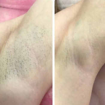 Діана Васильєва, Харків Фото - 5