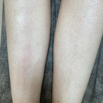 Виктория Орехова, Харьков Фото - 5