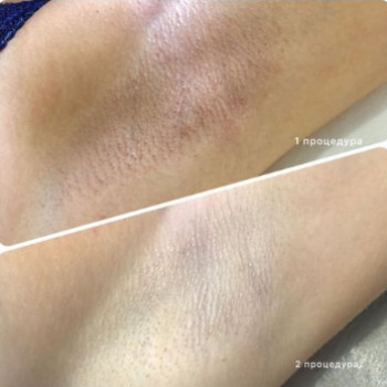 Eco Laser, Харків Фото - 5