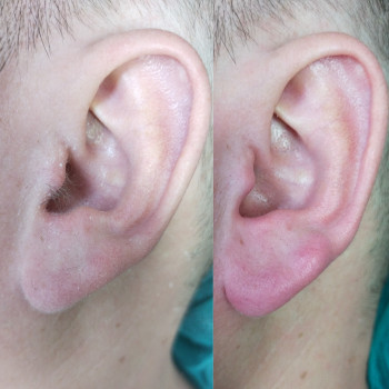 Марина Осіпова, Чернівці Фото - 5