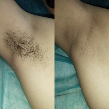 Марина Осіпова, Чернівці Фото - 4