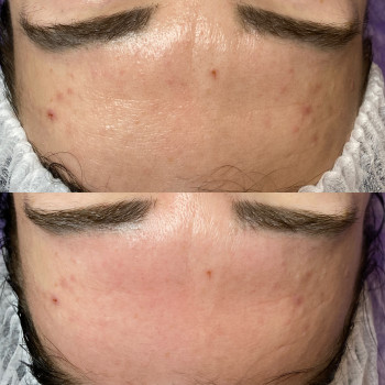 Анастасія Польгуй, Чернигов Фото - 54